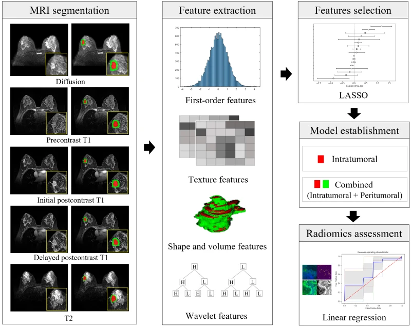 MRI radiomics workflow from tumor segmentation and feature extraction to model evaluation.